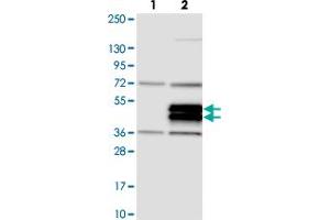 Western blot analysis of Lane 1: Negative control (vector only transfected HEK293T lysate). (TRIML2 Antikörper)