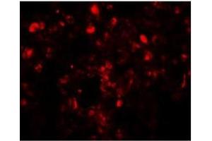 Immunofluorescence of Translin in human lung tissue with Translin antibody at 20 µg/ml. (Translin Antikörper  (C-Term))