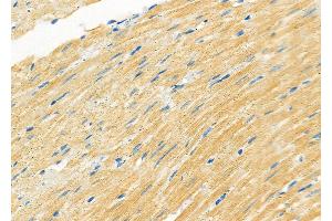 ABIN6263312 and ABIN6266806 at 1/100 staining Rat heart tissue by IHC-P. (Meningioma 1 Antikörper  (Internal Region))