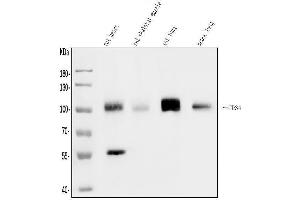 Western blot analysis of CD34 using anti-CD34 antibody (ABIN7600282).