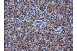 Immunohistochemical staining of paraffin-embedded Human pancreas tissue using anti-DSTN mouse monoclonal antibody. (Destrin Antikörper)