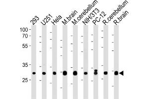 Western Blotting (WB) image for anti-Phosphatidylinositol Transfer Protein, alpha (PITPNA) antibody (ABIN3004594) (PITPNA Antikörper)