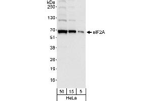 Western Blotting (WB) image for anti-Eukaryotic Translation Initiation Factor 2A, 65kDa (EIF2A) (AA 525-575) antibody (ABIN7453862)