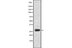 Western blot analysis of FA58A expression in HEK293 cells ,The lane on the left is treated with the antigen-specific peptide. (FAM58A Antikörper  (Internal Region))