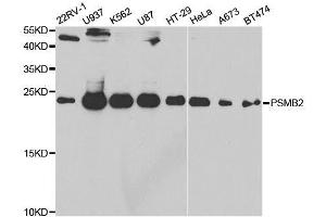 Western blot analysis of extracts of various cell lines, using PSMB2 antibody. (PSMB2 Antikörper  (AA 1-201))
