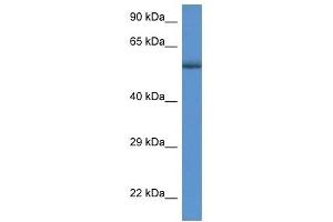 Western Blot showing GBA antibody used at a concentration of 1 ug/ml against MDA-MB-435S Cell Lysate (GBA Antikörper  (C-Term))