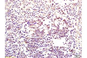 Immunohistochemistry (IHC) image for anti-Pleckstrin Homology Domain Containing, Family O Member 1 (PLEKHO1) (AA 51-170) antibody (ABIN675039)