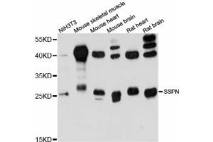 Western blot analysis of extracts of various cell lines, using SSPN antibody (ABIN6293742) at 1:3000 dilution.