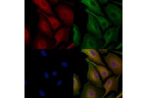 ABIN6259672 and ABIN6278181 staining  cells by IF/ICC. (ABAT Antikörper  (Internal Region))