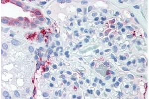 Anti-SLC39A14 antibody  ABIN1049336 IHC staining of human kidney.