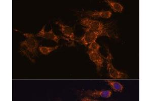 Immunofluorescence analysis of C6 cells using PYCR2 Polyclonal Antibody at dilution of 1:100. (PYCR2 Antikörper)