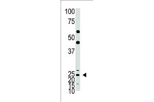 The anti-Hash1 Pab  is used in Western blot to detect Hash1 in mouse lung tissue lysate. (ASCL1 Antikörper  (C-Term))