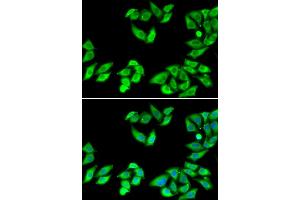 Immunofluorescence analysis of MCF-7 cells using RPS14 antibody. (RPS14 Antikörper)
