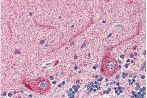 Immunohistochemistry (IHC) image for anti-Solute Carrier Family 22 (Organic Cation Transporter), Member 17 (SLC22A17) (Internal Region) antibody (ABIN335163)