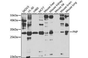 Western blot analysis of extracts of various cell lines, using PNP antibody  at 1:1000 dilution. (PNP Antikörper  (AA 1-289))