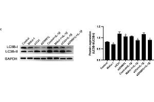 DNM1L deficiency reduces ROS production and autophagy in FLS. (GAPDH Antikörper)