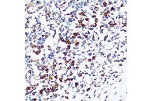 Immunohistochemistry of paraffin-embedded human tonsil using RPN1 antibody. (RPN1 Antikörper  (AA 20-280))