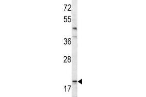 Western blot analysis of Bad antibody and mouse bladder tissue lysate