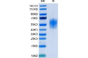 IL4 Receptor Protein (AA 24-232) (His tag)