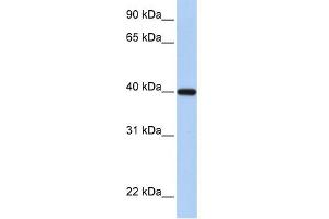 WB Suggested Anti-RDH11 Antibody Titration:  0. (RDH11 Antikörper  (C-Term))