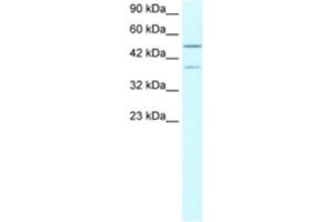 Western Blotting (WB) image for anti-Ubiquitin Specific Peptidase 3 (USP3) antibody (ABIN2460783) (USP3 Antikörper)