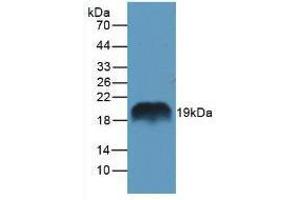 Western blot analysis of Rat Pancreas Tissue. (REG1A Antikörper  (AA 10-165))