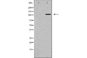 Western blot analysis of BUB1 expression in COLO205 cells,The lane on the left is treated with the antigen-specific peptide. (BUB1 Antikörper  (Internal Region))