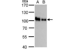 WB Image CD44 antibody detects CD44 protein by western blot analysis. (CD44 Antikörper)