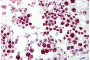 Human Testis (formalin-fixed, paraffin-embedded) stained with EZH2 antibody ABIN337251 at 5 ug/ml followed by biotinylated goat anti-rabbit IgG secondary antibody ABIN481713, alkaline phosphatase-streptavidin and chromogen. (EZH2 Antikörper  (Internal Region))