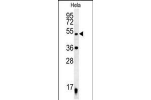 Western blot analysis in Hela cell line lysates (35ug/lane). (DDX47 Antikörper  (C-Term))