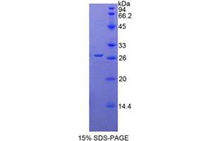 SDS-PAGE analysis of Mouse CYR61 Protein.