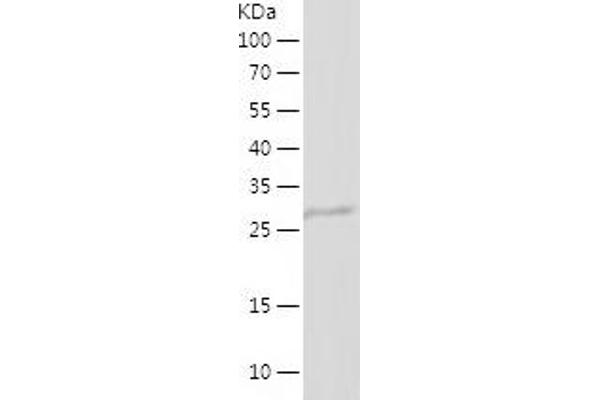 ANG Protein (AA 25-147) (His-IF2DI Tag)