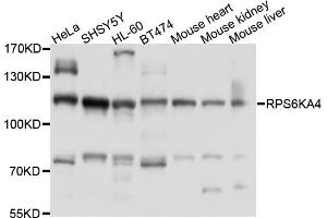Western blot analysis of extracts of various cell lines, using RPS6KA4 antibody (ABIN6003828) at 1/1000 dilution. (MSK2 Antikörper)