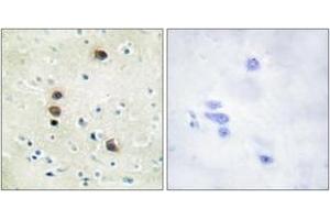 Immunohistochemistry analysis of paraffin-embedded human brain, using PKD1/PKC mu (Phospho-Ser205) Antibody. (PKC mu Antikörper  (pSer205))