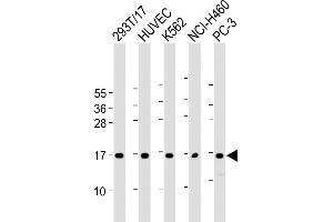 All lanes : Anti-CCL26 Antibody (C-Term) at 1:2000 dilution Lane 1: 293T/17 whole cell lysate Lane 2: HUVEC whole cell lysate Lane 3: K562 whole cell lysate Lane 4: NCI- whole cell lysate Lane 5: PC-3 whole cell lysate Lysates/proteins at 20 μg per lane.