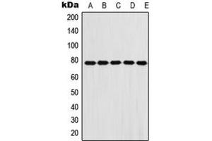 Western blot analysis of Fibulin 1 expression in A431 (A), A549 (B), HeLa (C), NIH3T3 (D), H9C2 (E) whole cell lysates. (Fibulin 1 Antikörper  (Center))