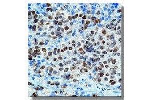 Immunohistochemistry (IHC) image for anti-Microphthalmia-Associated Transcription Factor (MITF) antibody (ABIN264430) (MITF Antikörper)