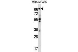 CTAGE5 Antibody (C-term) western blot analysis in MDA-MB435 cell line lysates (35µg/lane). (MIA2 Antikörper  (C-Term))