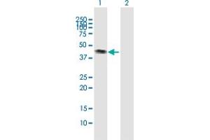 Western Blot analysis of CALR3 expression in transfected 293T cell line by CALR3 MaxPab polyclonal antibody. (Calreticulin 3 Antikörper  (AA 1-384))