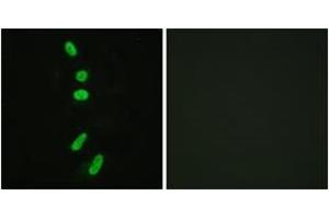 Immunofluorescence analysis of HeLa cells, using SF1 (Ab-82) Antibody. (Splicing Factor 1 Antikörper  (AA 48-97))