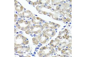 Immunohistochemistry of paraffin-embedded human stomach using MAPKBP1 antibody (ABIN5971432) at dilution of 1/100 (40x lens). (MAPKBP1 Antikörper)