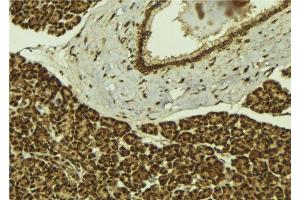 ABIN6279403 at 1/100 staining Mouse pancreas tissue by IHC-P.