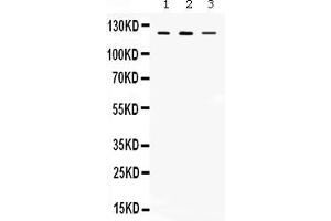 Western blot analysis of CIITA expression in rat thymus extract ( Lane 1), mouse thymus extract ( Lane 2) and MCF-7 whole cell lysates ( Lane 3). (CIITA Antikörper  (AA 945-1130))