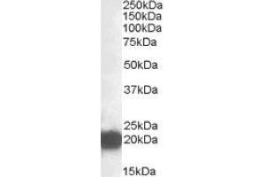 Image no. 1 for anti-Cysteine and Glycine-Rich Protein 3 (CSRP3) (Internal Region) antibody (ABIN375064)