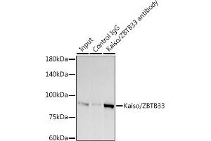 Immunoprecipitation analysis of 300 μg extracts of A-549 cells using 3 μg Kaiso/ZBTB33 antibody (ABIN7271437). (ZBTB33 Antikörper)