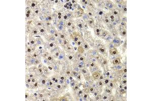 Immunohistochemistry of paraffin-embedded rat liver using HIRIP3 antibody. (HIRIP3 Antikörper)