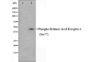 Western blot analysis on Jurkat cell lysate using Phospho-Retinoic Acid Receptor alpha (Ser77) Antibody,The lane on the left is treated with the antigen-specific peptide.