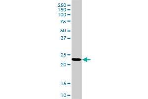 RPL18 MaxPab rabbit polyclonal antibody. (RPL18 Antikörper  (AA 1-188))