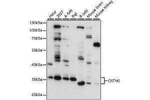 Western blot analysis of extracts of various cell lines, using OSTM1 antibody (ABIN4904622) at 1:3000 dilution. (OSTM1 Antikörper)