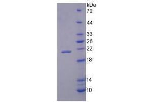SDS-PAGE analysis of Human NOX4 Protein. (NADPH Oxidase 4 Protein (NOX4))